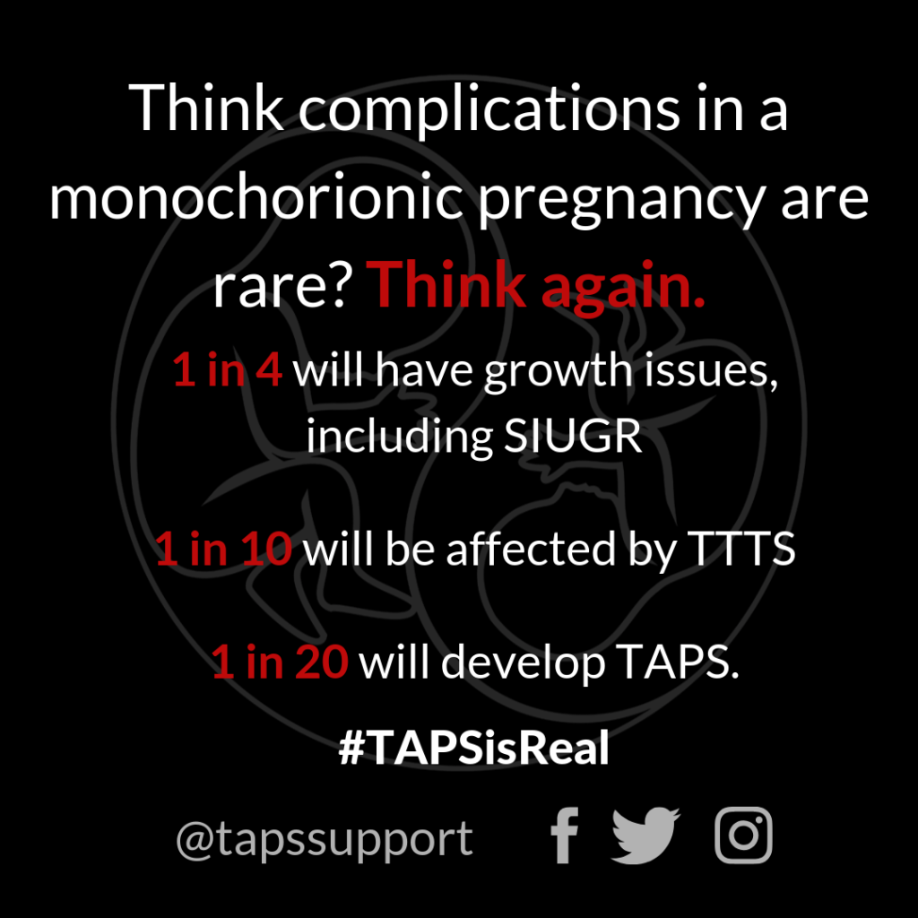 complications monochorionic twins taps support ttts siugr
